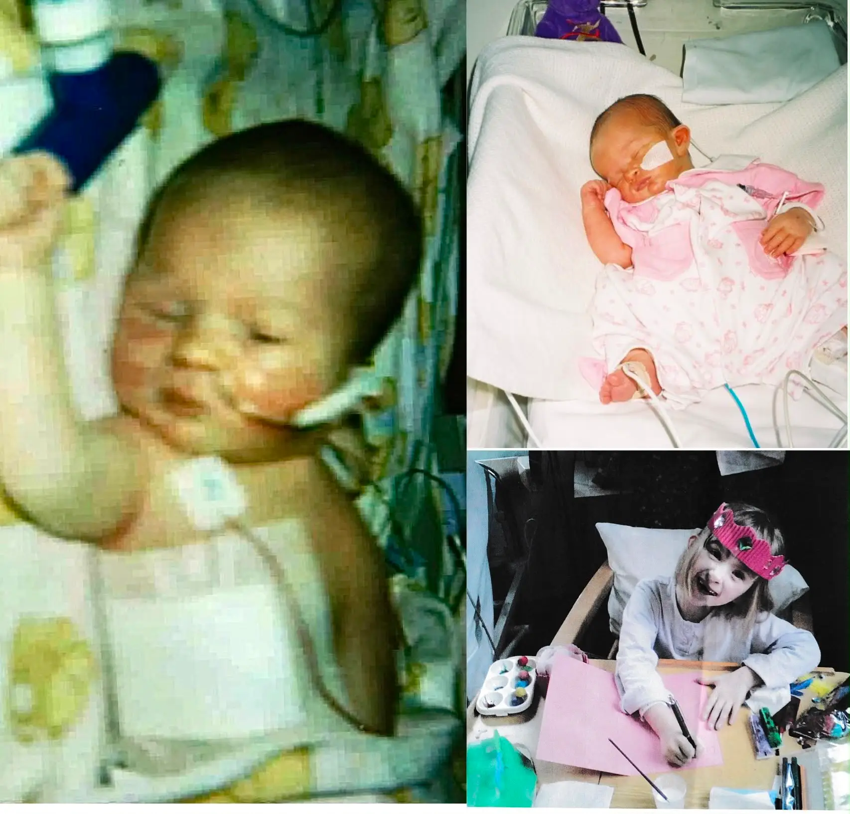 Woman Born With Half a Heart Stuns Doctors by Delaying Transplant Around 15 Years
