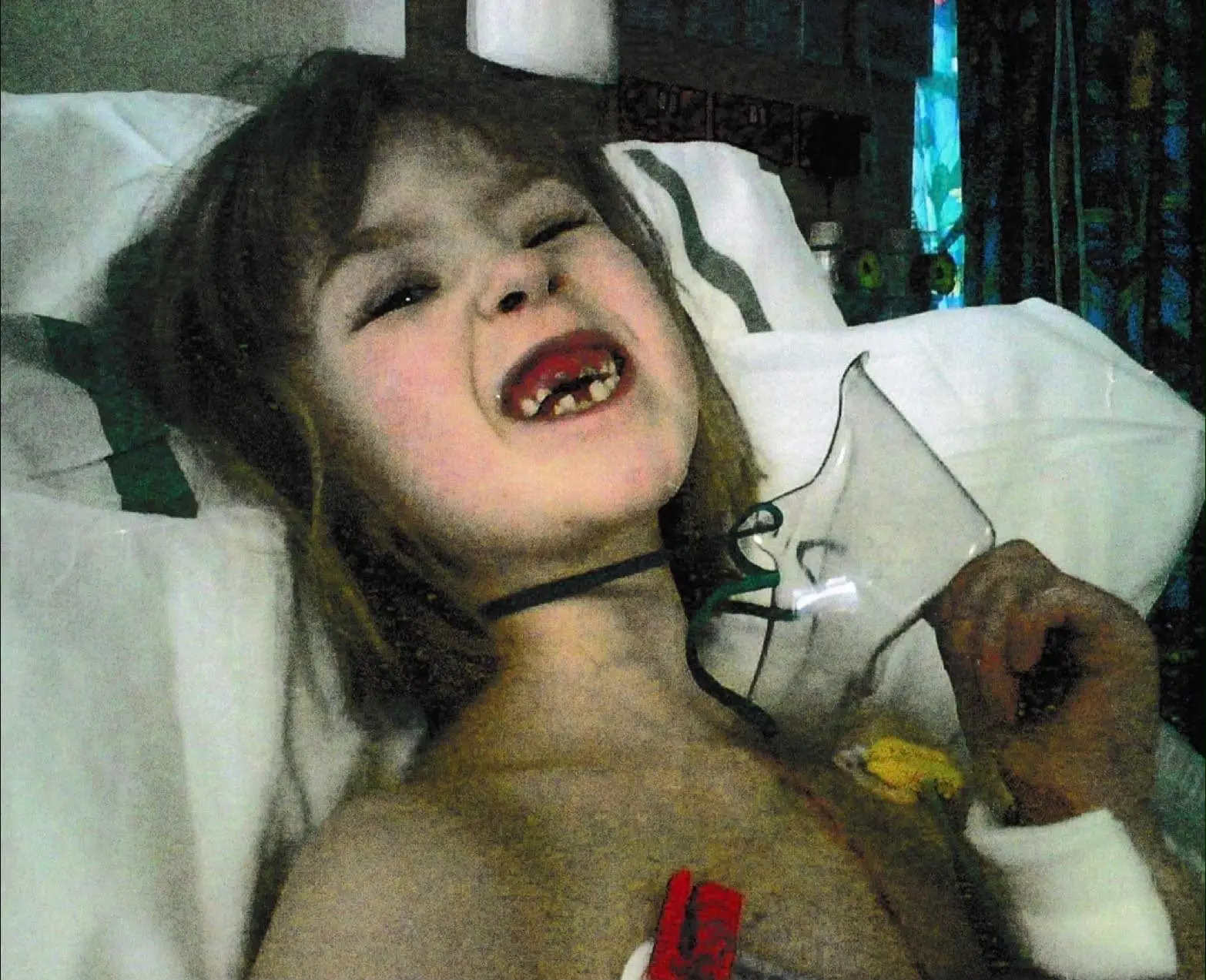 Woman Born With Half a Heart Stuns Doctors by Delaying Transplant Around 15 Years