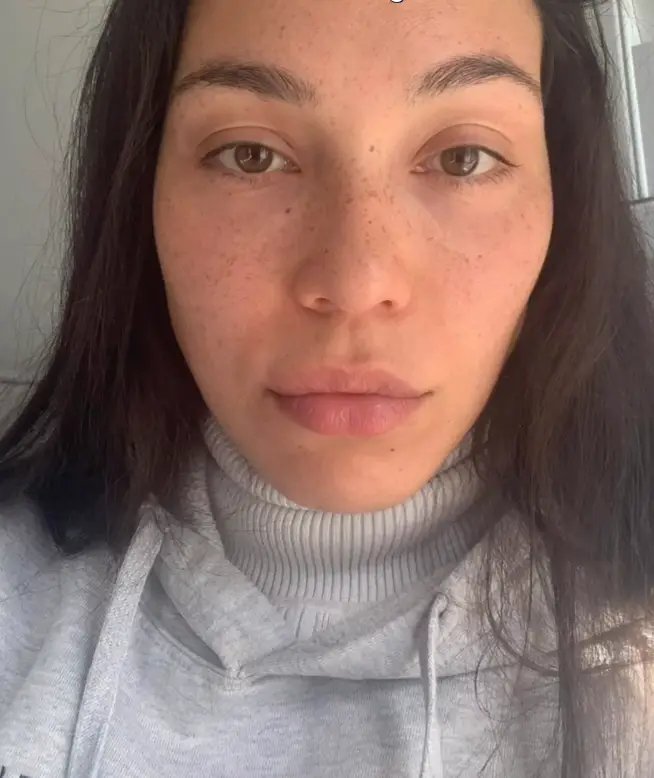 Woman Reveals Insane Facial Transformation After Quitting Sugar and Alcohol for 18 Months