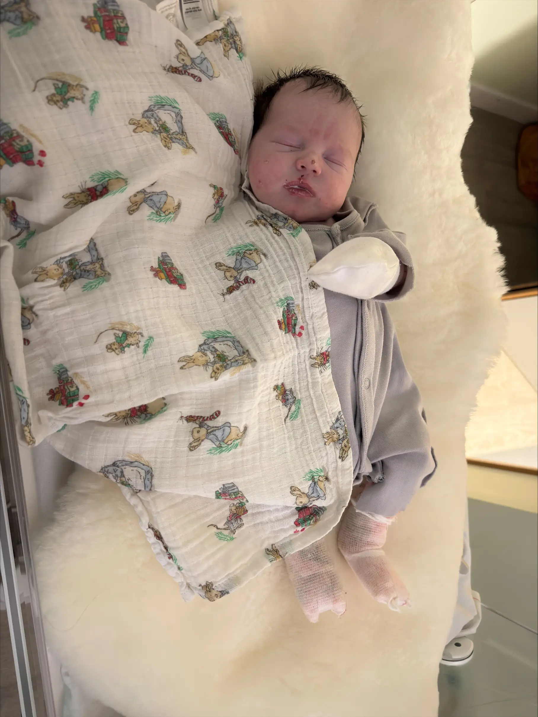Mom's Agony as Heartbreaking Butterfly Skin Condition Stops Her Holding Her Baby