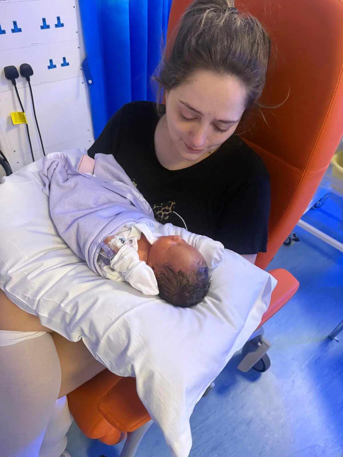 Mom's Agony as Heartbreaking Butterfly Skin Condition Stops Her Holding Her Baby