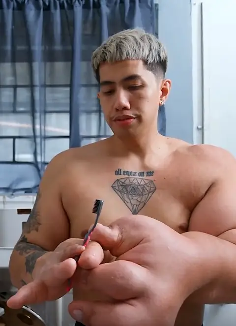 Man with 20lb Hands Shuts Down Cruel Myths About Love and Fatherhood