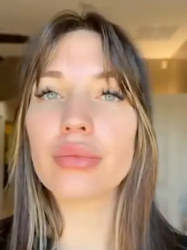 Woman Reveals Stunning Facial Transformation After Seven Years of Alcohol Abuse