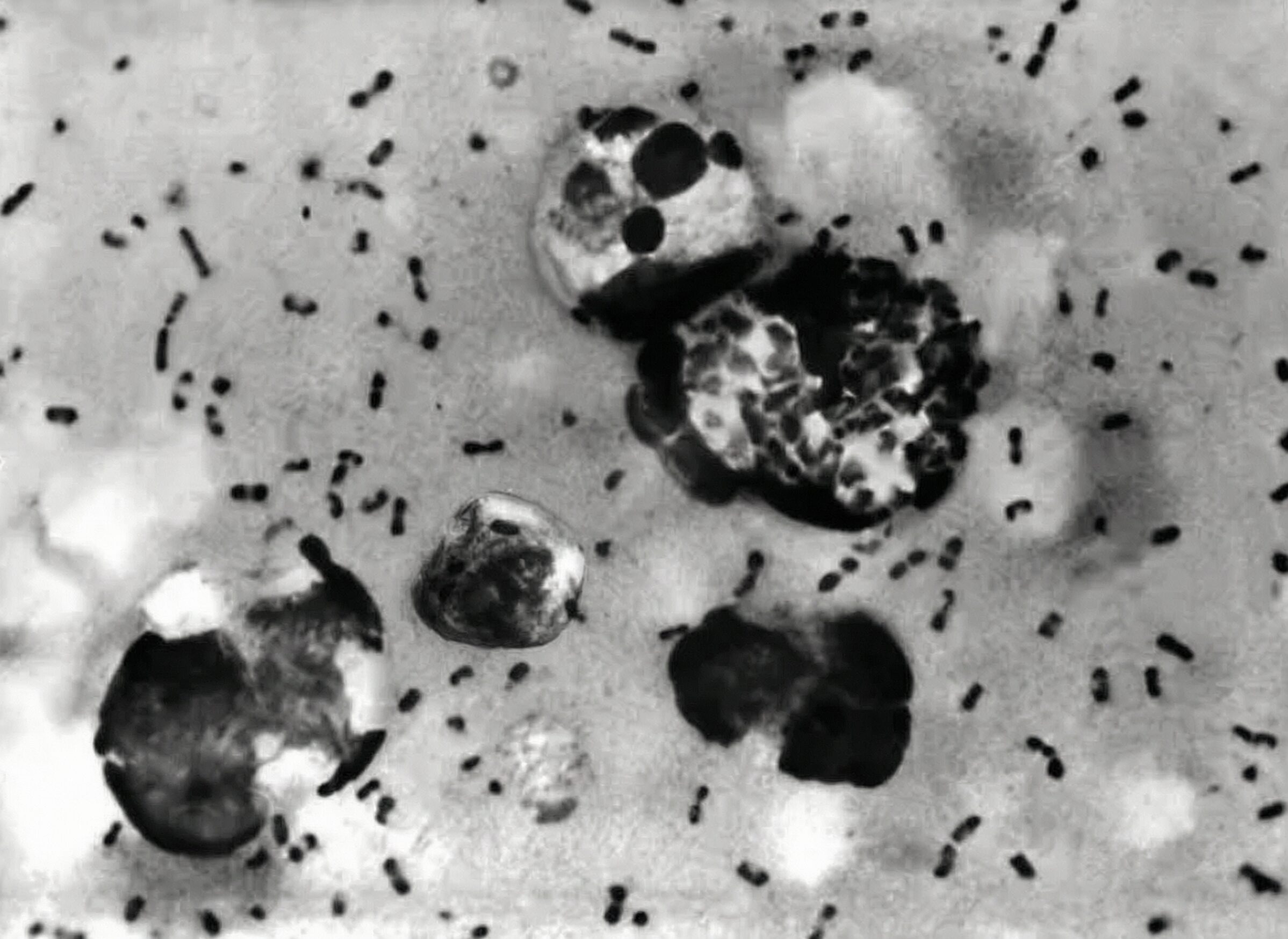 Dozens Quarantined as Mystery Infection Kills Researcher at Russian Plague Lab
